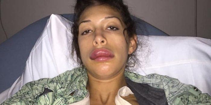 Farrah_Abraham_lips1